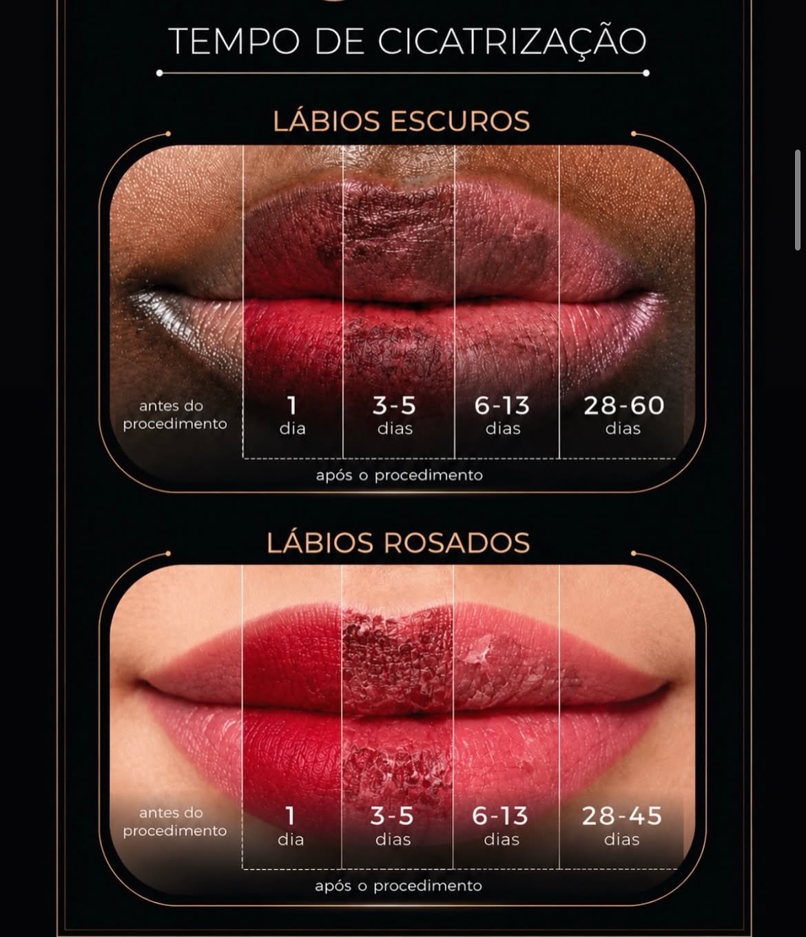Linha do tempo de cicatrização da micropigmentação labial, lábios escuros e rosados