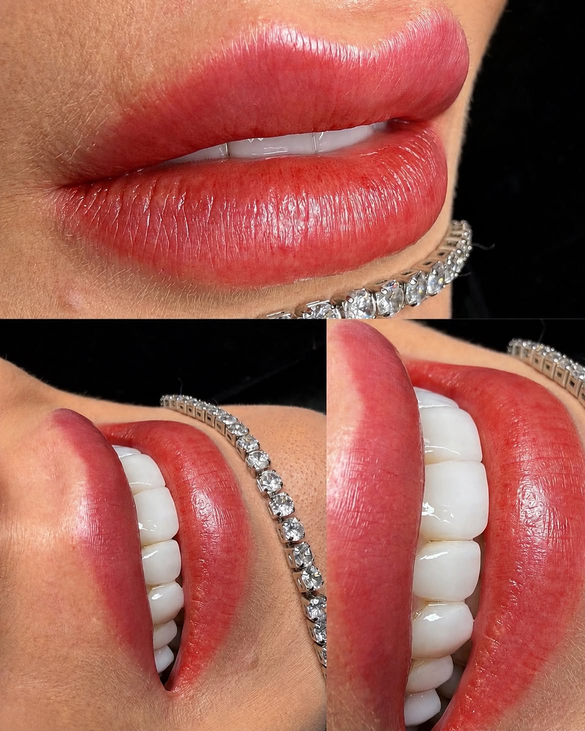 Resultado de micropigmentação labial - lábios naturais com brilho