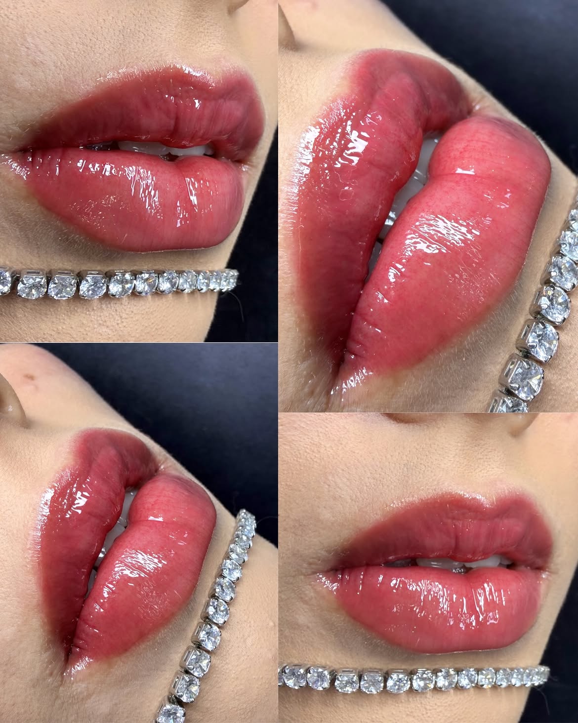 Resultado de micropigmentação labial - lábios cicatrizados