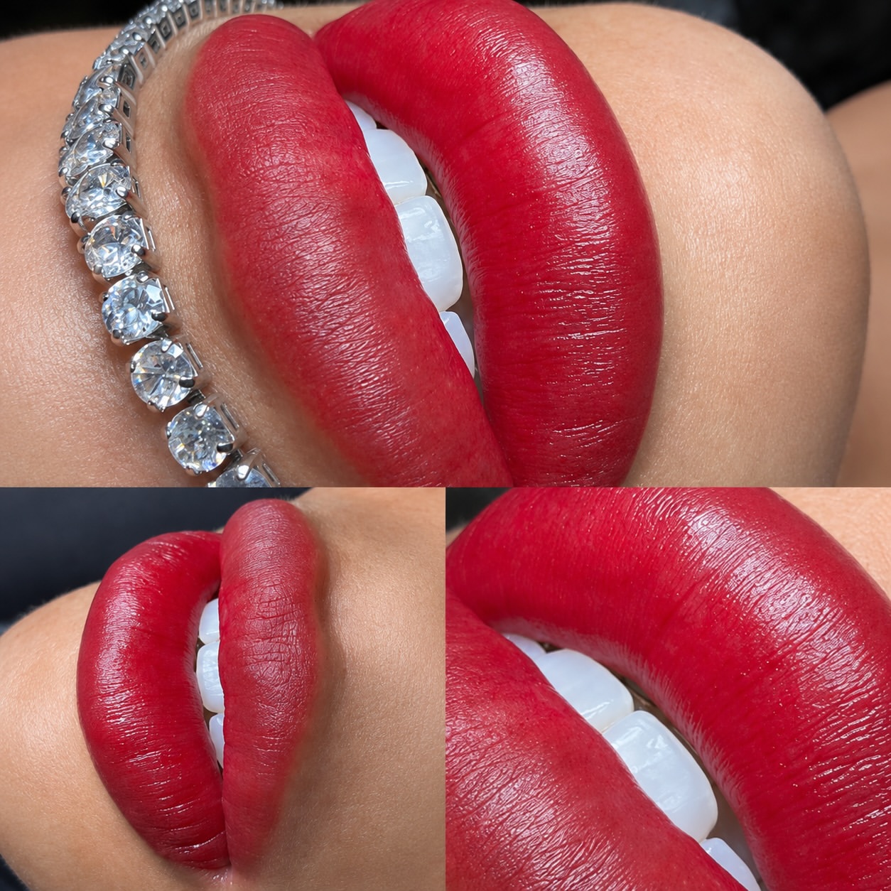 Resultado de micropigmentação labial - contorno definido