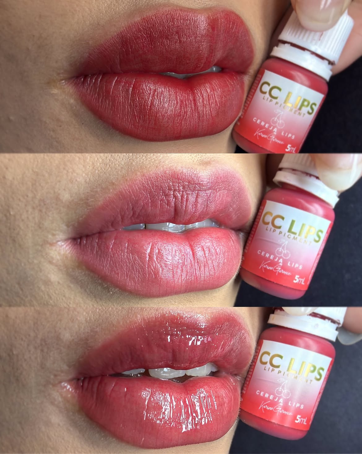 Resultado de micropigmentação labial - cor intensa pós procedimento