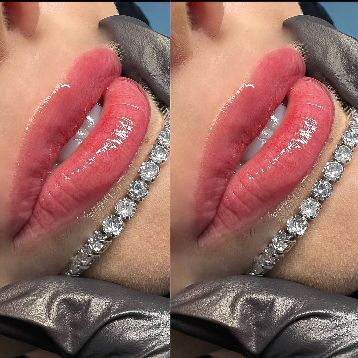 Resultado de micropigmentação labial - técnica Nano Lips