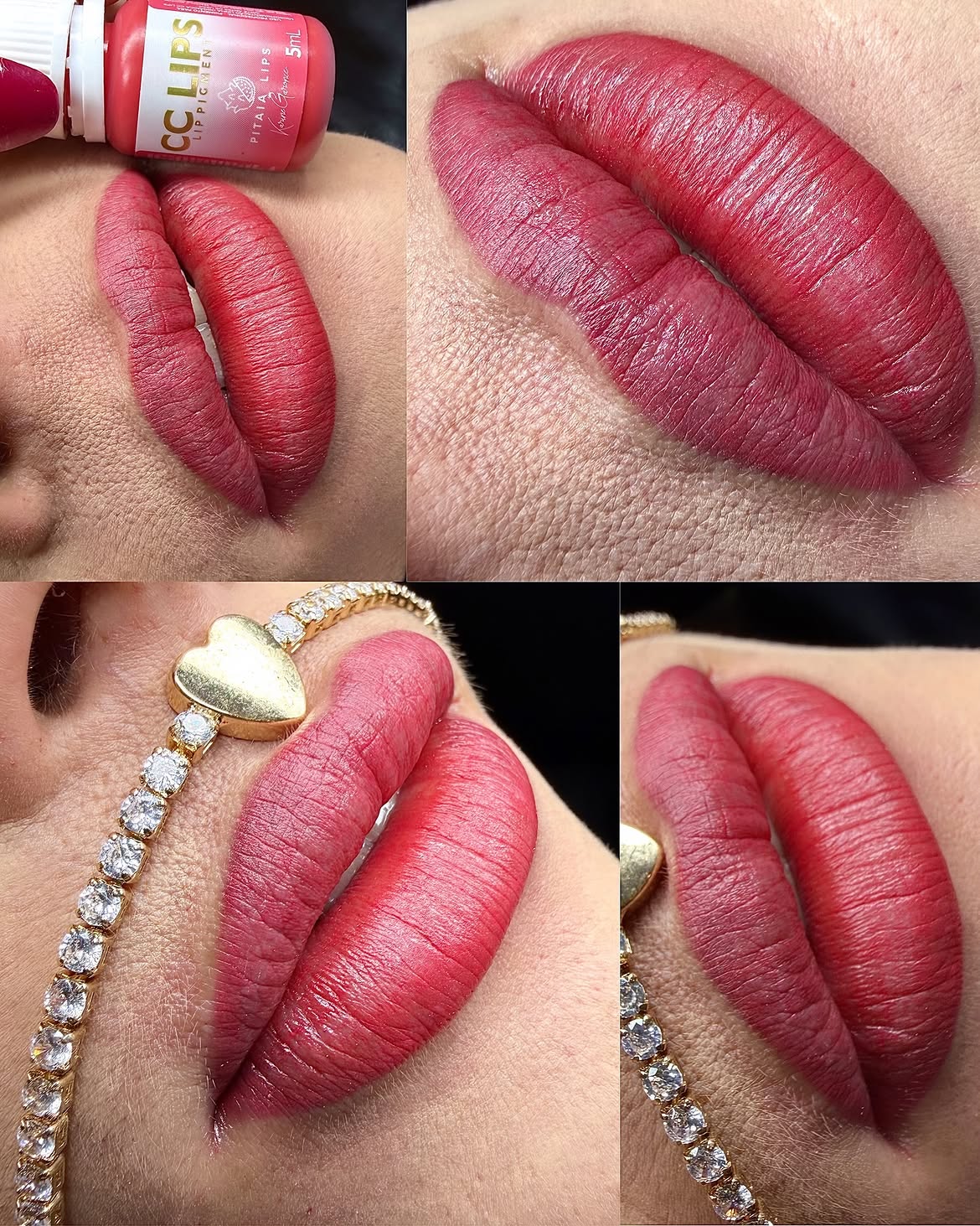 Resultado de micropigmentação labial - lábios renovados